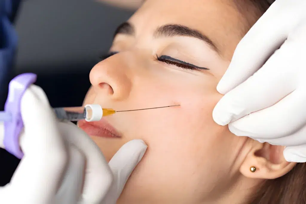 Filler_cearcane_Skina_Dermatologie_Bucuresti