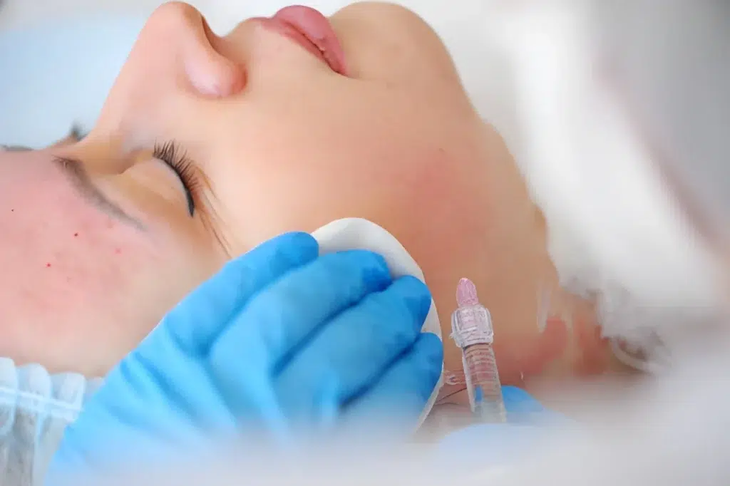 Mezoterapie_Skina_Dermatologie_Bucuresti