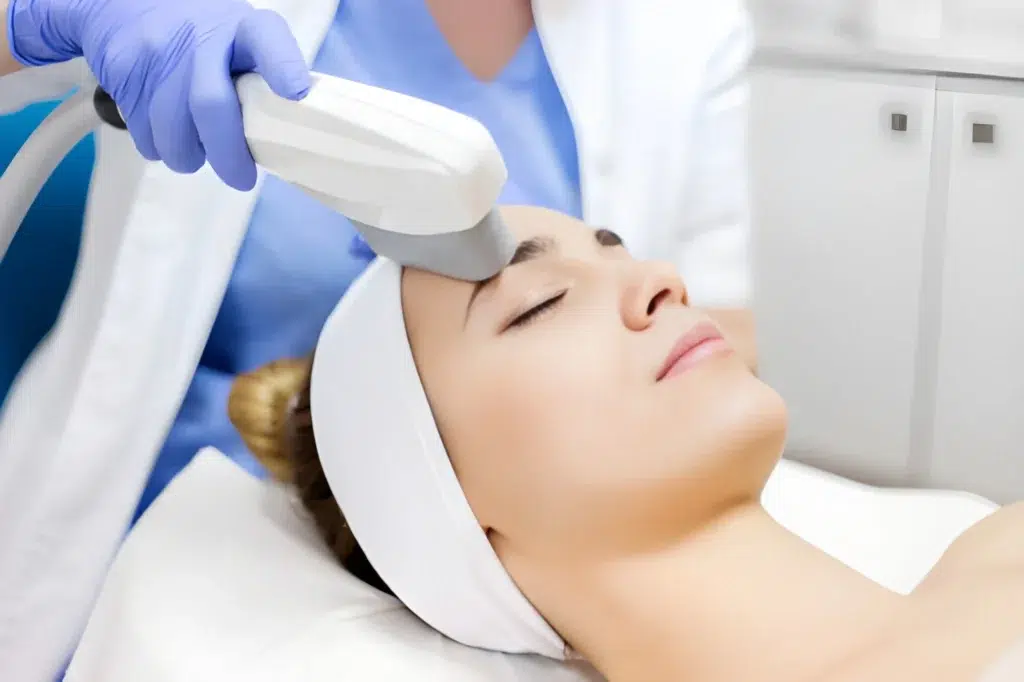 Terapie_IPL_Skina_Dermatologie_Bucuresti