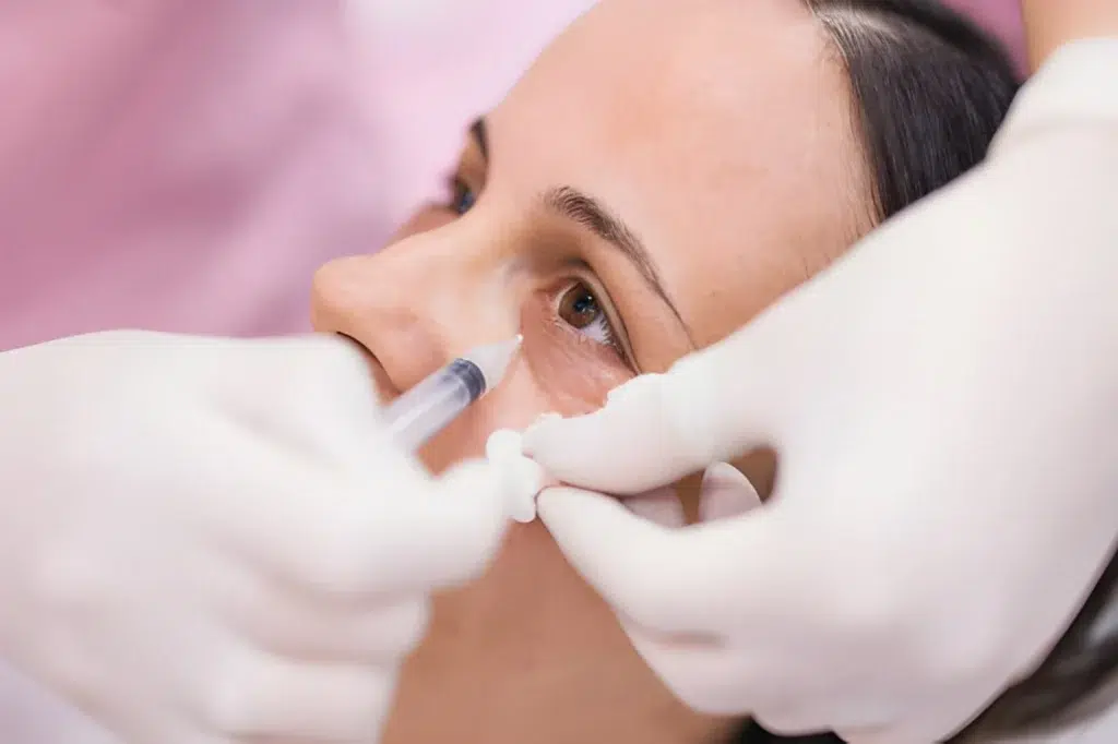 Tratament_cearcane_Jalupro_Skina_Dermatologie_Bucuresti